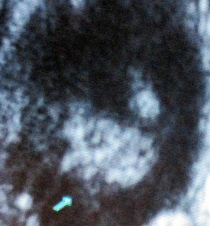 Revelations in a sonogram