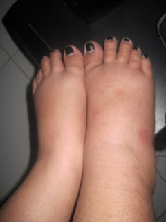 No feet can get bigger than this