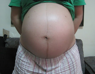Pregnancy Discomforts: What They Didn’t Tell You About Pregnancy